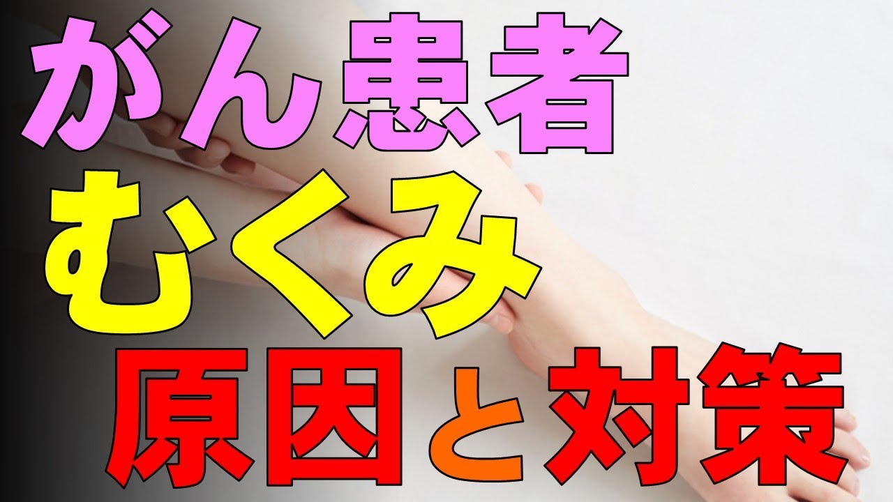がん患者にみられるむくみ（浮腫）の原因と対策：医師が解説