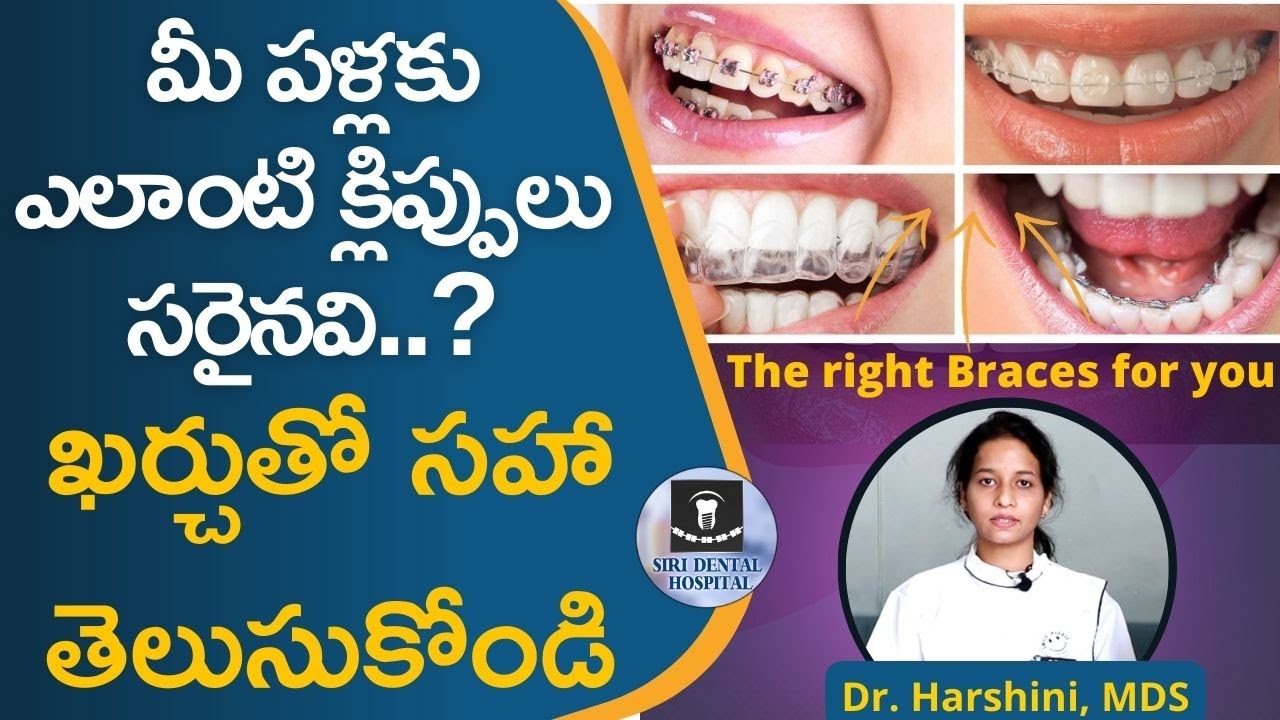 మీ దంతాలకు ఎలాంటి క్లిప్పులు సరైనవో తెలుసా..? | Types of Braces COMPARED & EXPLAINED | Siri Dental