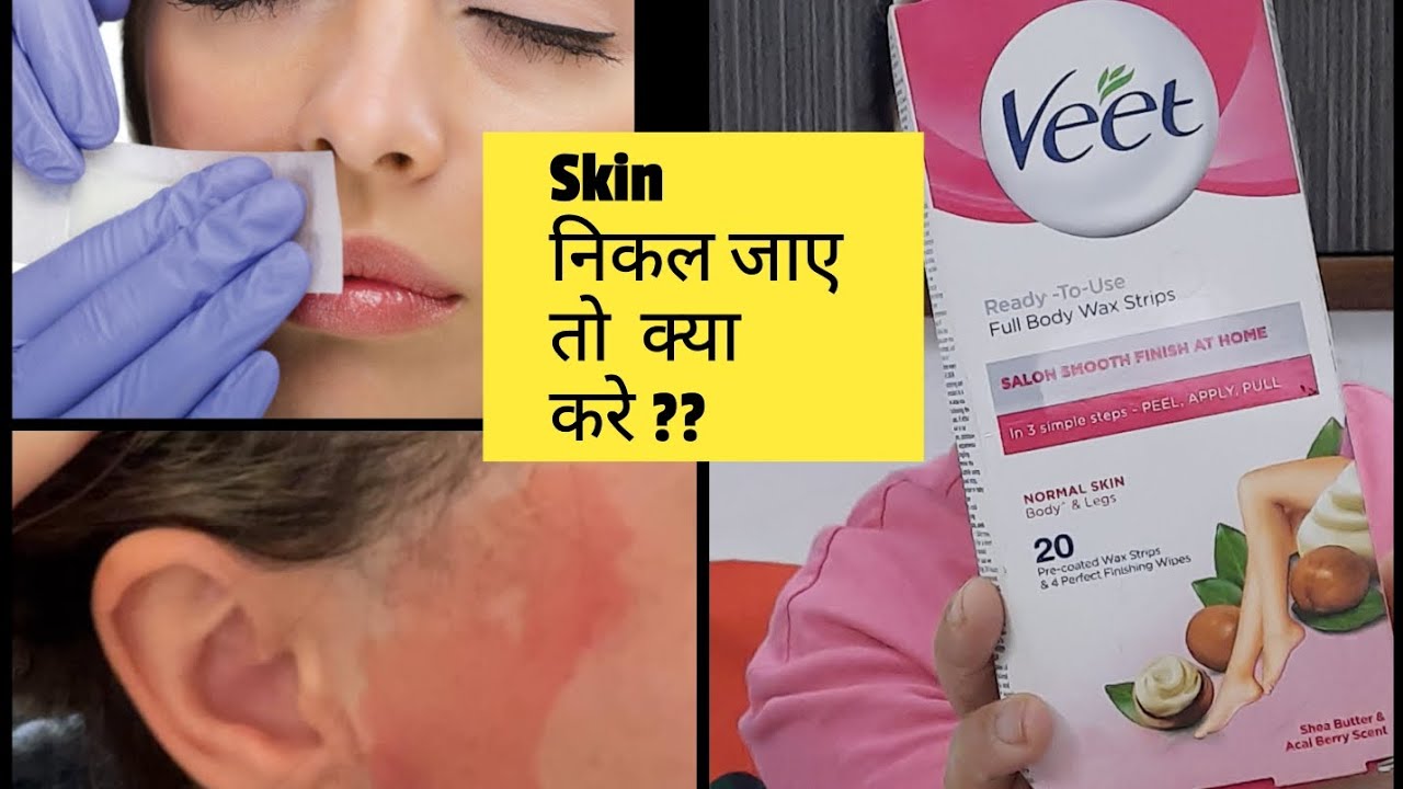 Face Wax के  बाद  Skin  निकल  जाए  तो  क्या  करे|Face Wax के  बाद  Redness kaise हटाये #facewaxing