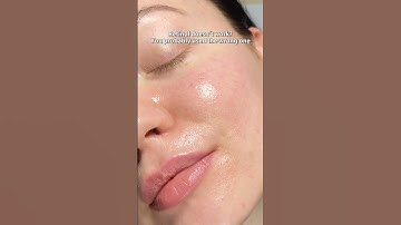 Retinol before and after | Real results, peeling, glow & how to use retinol for beginners