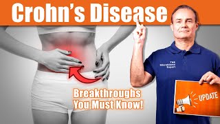 Crohn’s Disease Update: New Insights and Studies | The Microbiome Expert