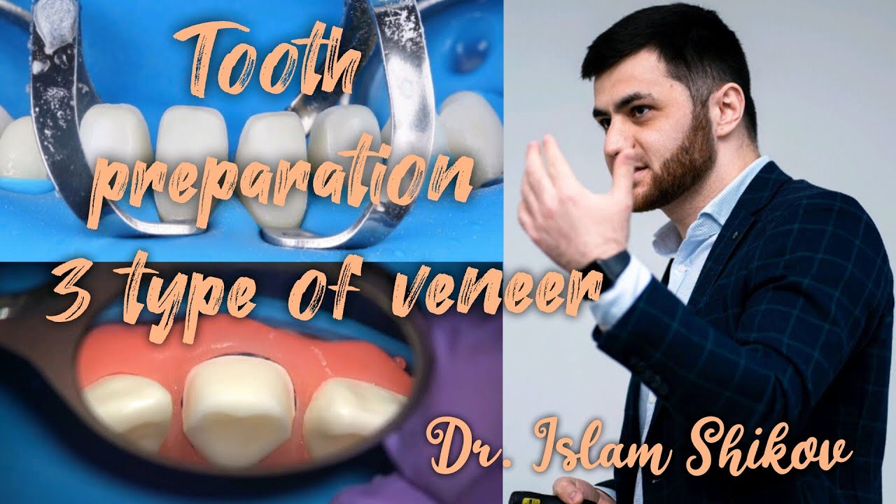 Preparation of teeth for type 3 veneer. Demonstration video. Dr.Islam