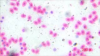 Frog blood smear under microscope