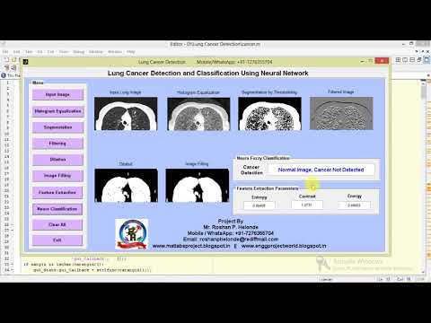 Lung Cancer Detection and Classification Using Neural Network Matlab Project IEEE Based Project
