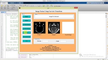 Image Fusion Using Curvelet Transform Matlab Project with Source Code