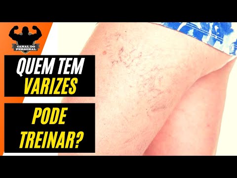 Paciente com vasculite sistêmica uk