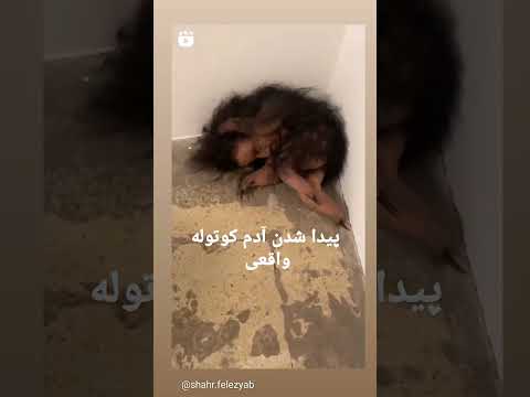 اینم یه آدم کوتوله واقعی