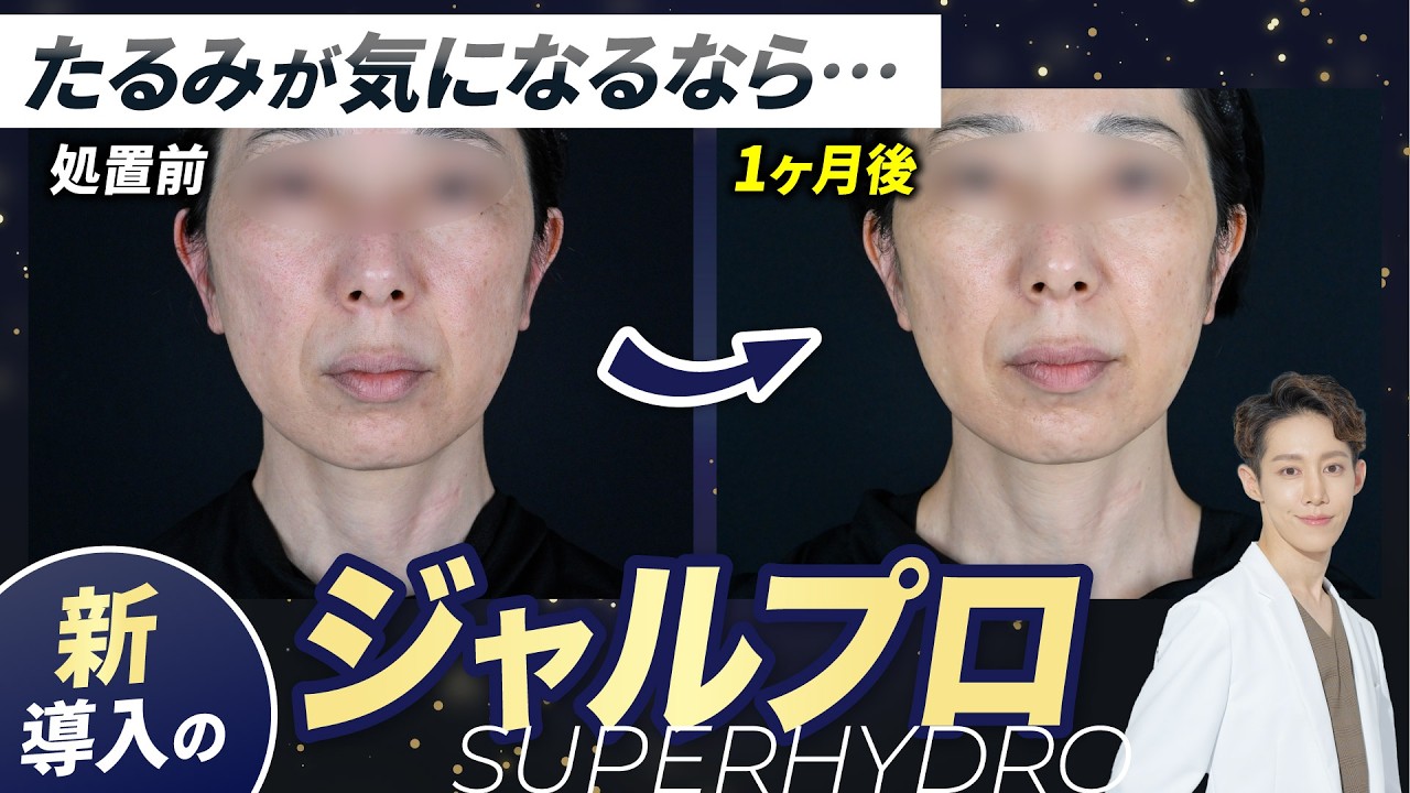 【新・肌育治療】念願の導入『ジャルプロスーパーハイドロ』について徹底解説します！※モニター価格は￥54.800円が正しい価格です。