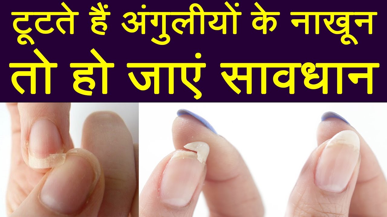 Reasons your Nails keep Breaking नाखून अक्सर टूट जातें है, तो ये है