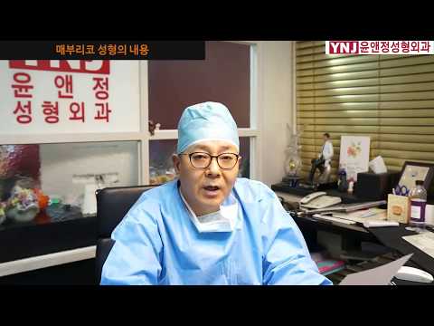 매부리코 성형의 내용