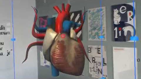 HoloLens Heart Demo