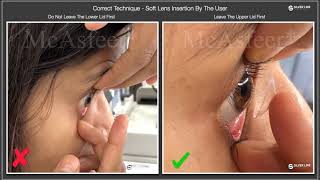 PREFERRED TECHNIQUE FOR - SOFT LENS INSERTION BY THE USER screenshot 1