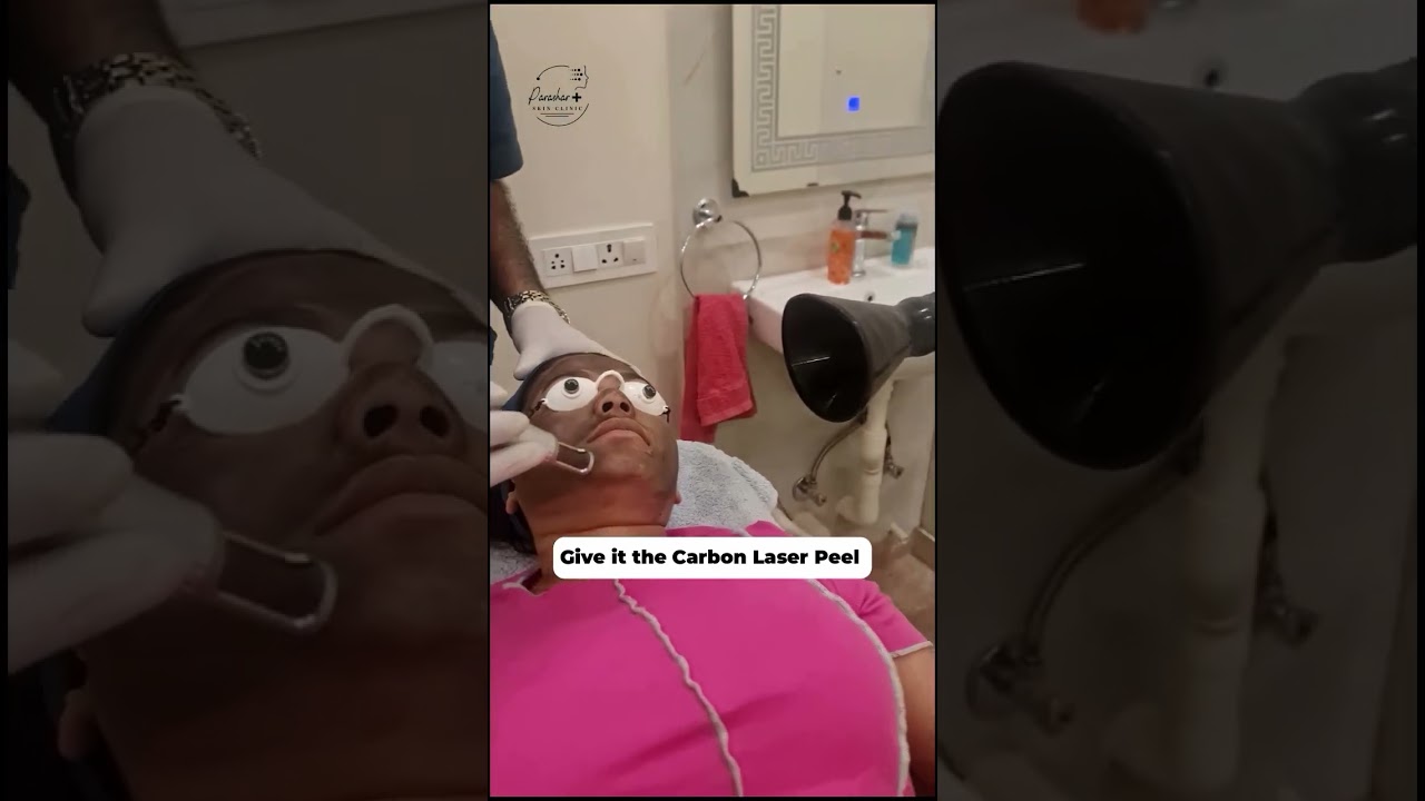 Carbon Laser Peel Explained | Instant Glow, Smooth Skin & Pre-Wedding Shine | Parashar Skin Clinic