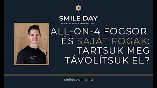 Saját Fogak Tartsuk Meg Vagy Távolítsuk El Teljes Új Fogsor Esetén?