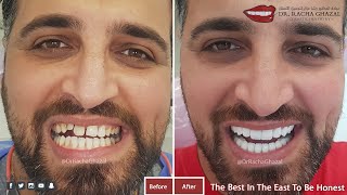 The Best In The East To be Honest smile from America to Dubai             ابتسامة من امريكا الي دبي
