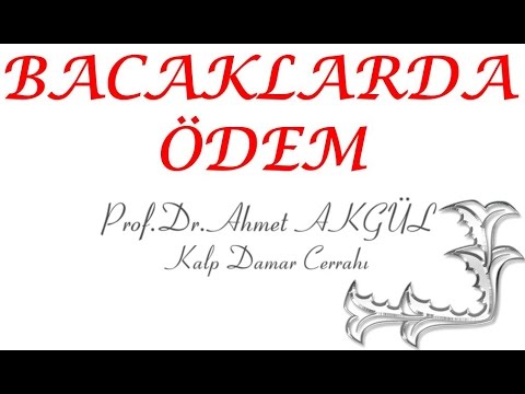 Bacak şişliği Tedavisi Için Geç Kalmayın - Prof. Dr. Ahmet AKGÜL