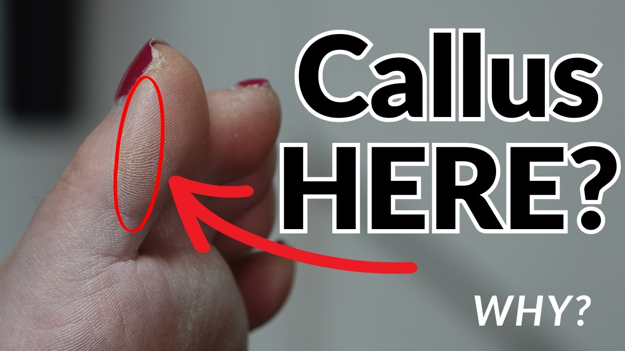 Callus of the Big Toe