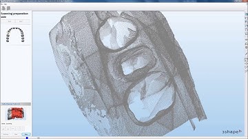 3Shape Impression Scanning Demo