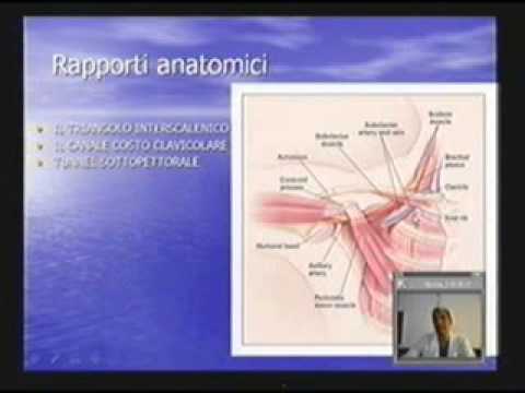 Video: Risposta Emodinamica A Indumenti Di Compressione Anti-shock Non Pneumatici In Pazienti Con Disfunzione Renale