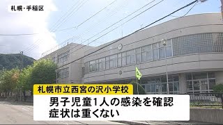 新型コロナ　北海道で新規感染者10人　札幌市の小学校の男子児童感染　　クラス全員PCR検査実施 (20/08/09 18:20)