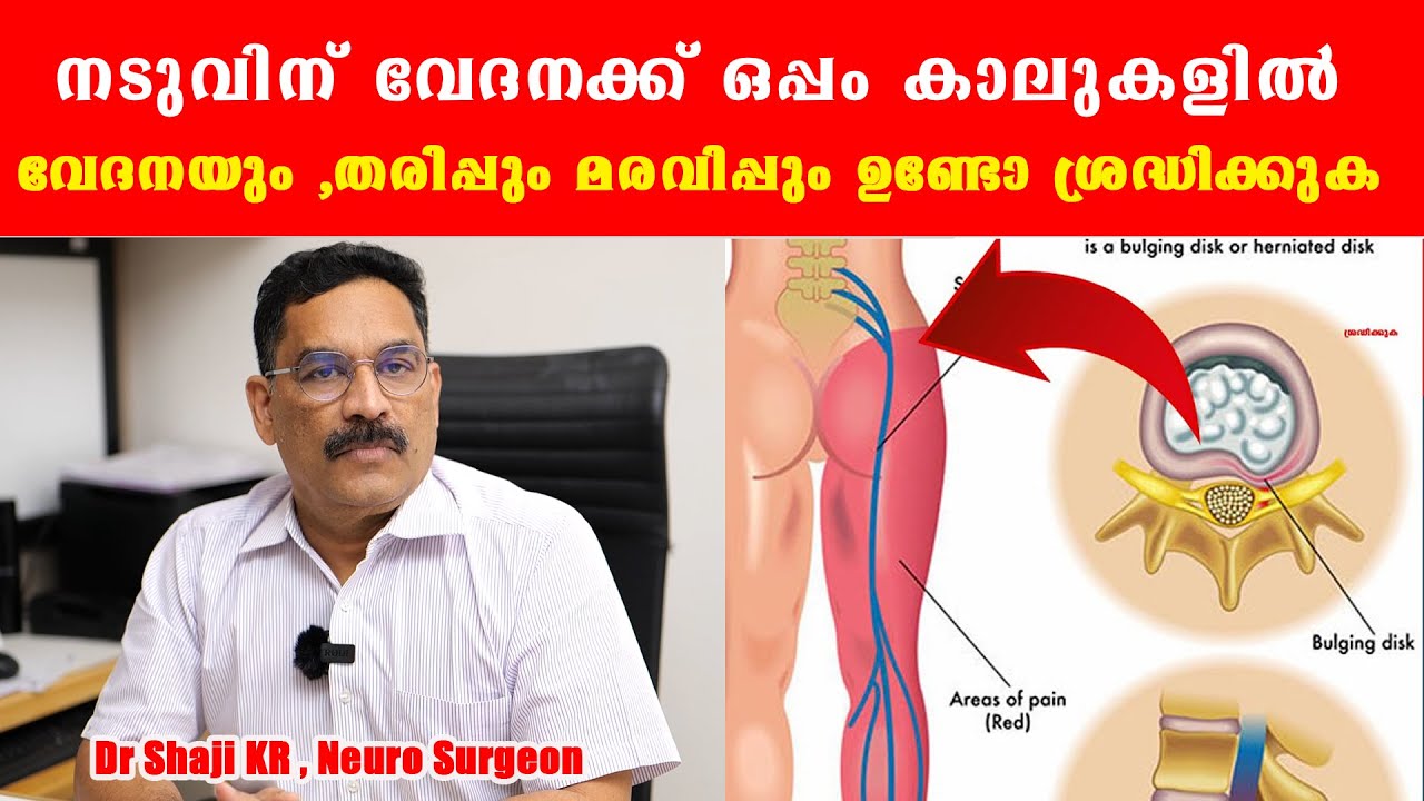 നടുവിന് വേദനക്ക് ഒപ്പം കാലുകളിൽ  വേദനയും ,തരിപ്പും മരവിപ്പും ഉണ്ടോ ശ്രദ്ധിക്കുക /Dr Shaji K R /PELD