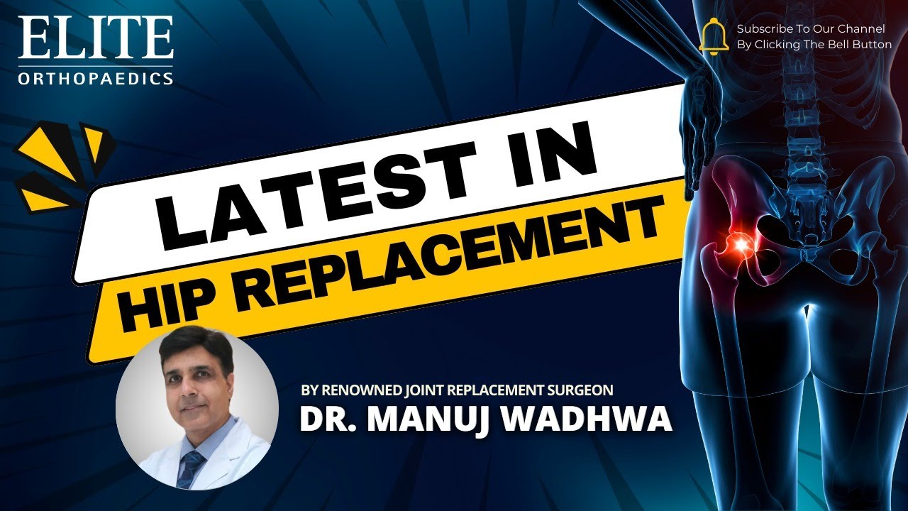 Best Knee Replacement Hospital in Punjab | Elite Orthopedics