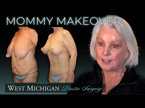 AMAZING MOMMY MAKEOVER - Surgery After #WeightLoss