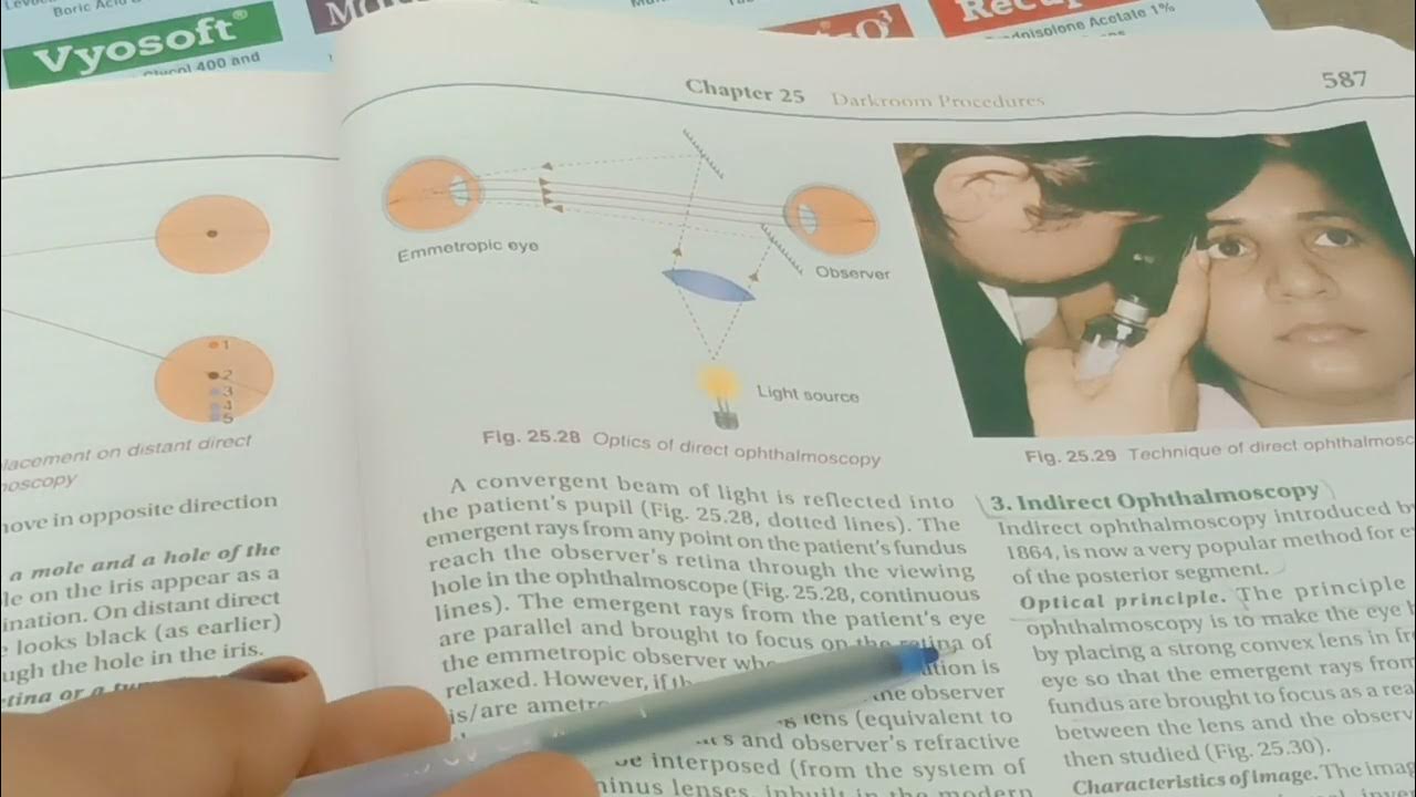 part 3Direct ophthalmoscope Optics parts Technique