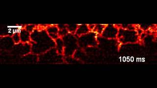 Instant SIM imaging of the endoplasmic reticulum