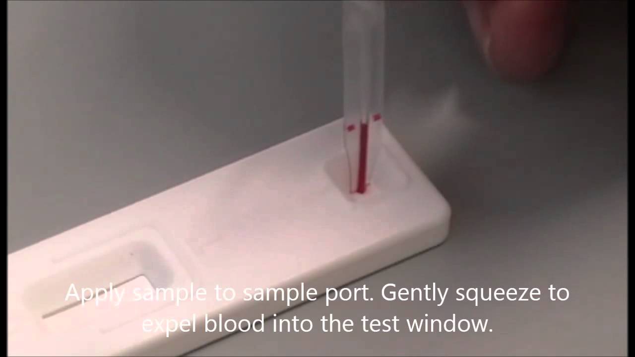 Equi Test EquiChek: Stable-side test for horses - YouTube