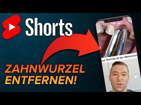 Video: Gilt der Rücktritt auch für Zweitwohnungen?