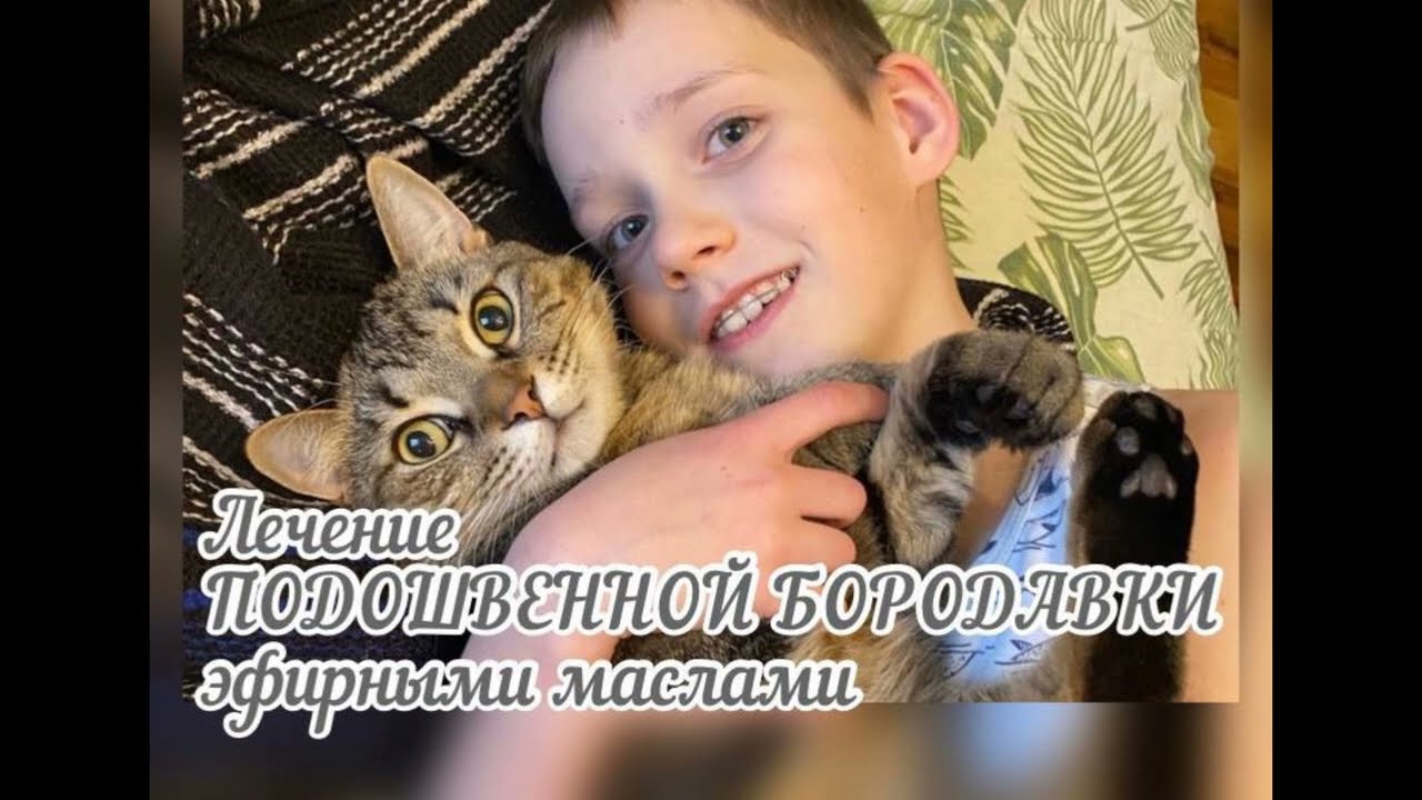 Лечение подошвенной бородавки эфирными маслами.
