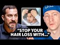 How to stop hair loss before its too late  surgeon reacts to hubermanlab