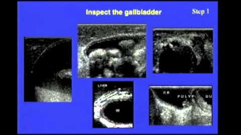 Intra-Operative Imaging of the biliary system - Ultrasonography