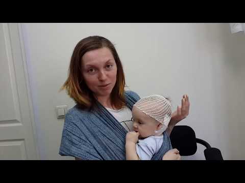 ППЦНС, кривошея у грудничка, родовая травма шейного отдела - отзыв лечении