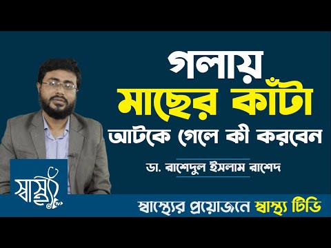 গলায় মাছের কাটা বিঁধলে করণীয় — গলায় কাঁটা বিঁধলে কী করবেন — গলায় কাঁটা আটকালে নামানোর উপায়