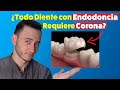 Si tienes Endodoncias, necesitas Corona en esos dientes. ¿Mito o realidad?