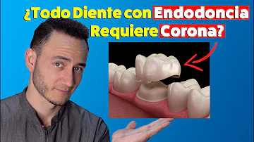 ¿Todas las coronas requieren una endodoncia?