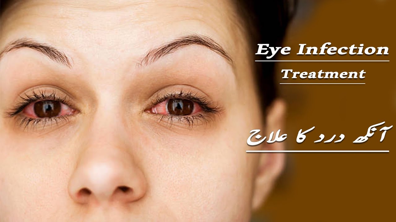 Eyes infection ankh dard ka ilaj YouTube
