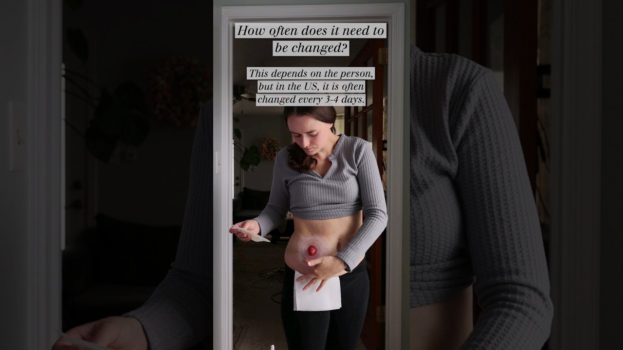 Ostomy Questions You Want the Answers To!