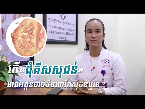 តើ«ដុំគីសសុដន់»អាចវិវត្តន៍ជាជំងឺមហារីកសុដន់ឬទេ? (ភាគ១)