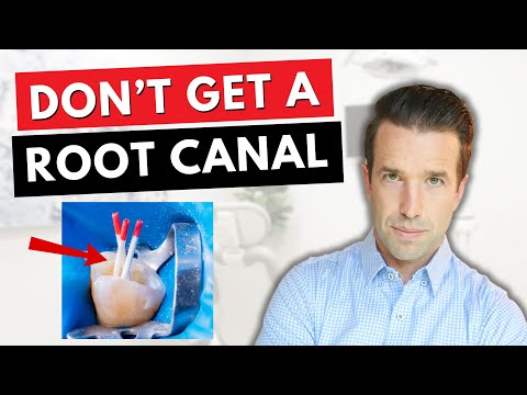 Don't get a ROOT CANAL before watching this!