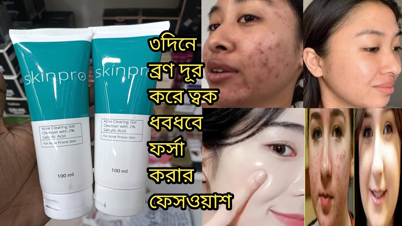 Skin Pro ##Skin Pro Acne Clearing Gel Cleanser,Review,Price,Benefits,How to use ...