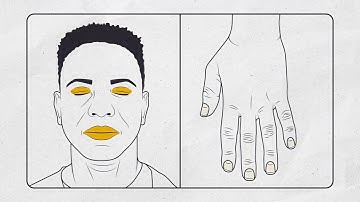 Video: Signs of an overdose and how to respond