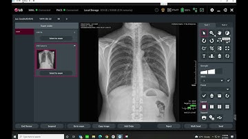 LG DR System v3.0 AWS Acquire Tutorial