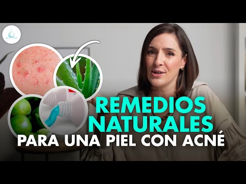 🔴 REMEDIOS CASEROS para ELIMINAR el ACNE ¿Mito o realidad? @drapilarochoa - Dermatologa