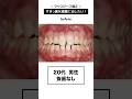 ワイヤーではなくマウスピース矯正したい方必見!#インビザライン #さいとう矯正歯科 #歯列矯正 #マウスピース矯正