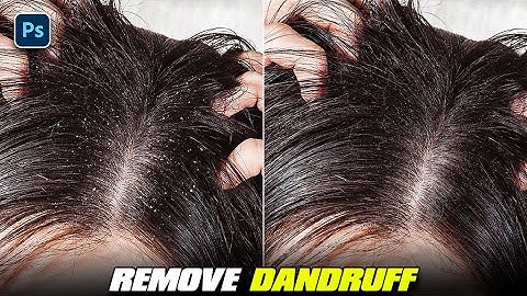 how to remove dandruff from hair in photoshop | One click remove dandruff from hair in photoshop