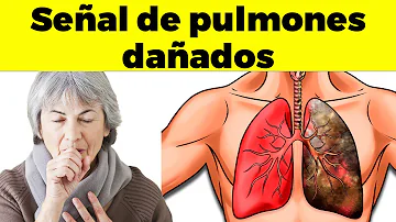 ¿Cuándo debo preocuparme por mis pulmones?