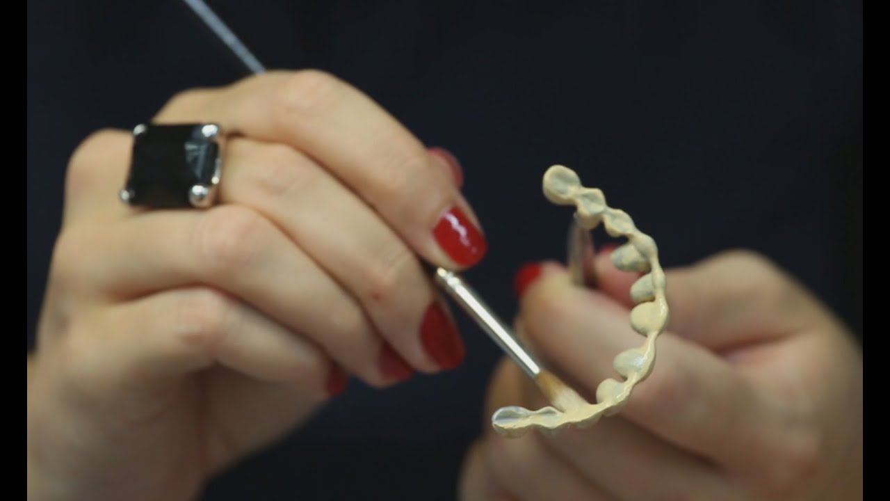 Bridge dentaire [création] - Endurance Implant Hongrie
